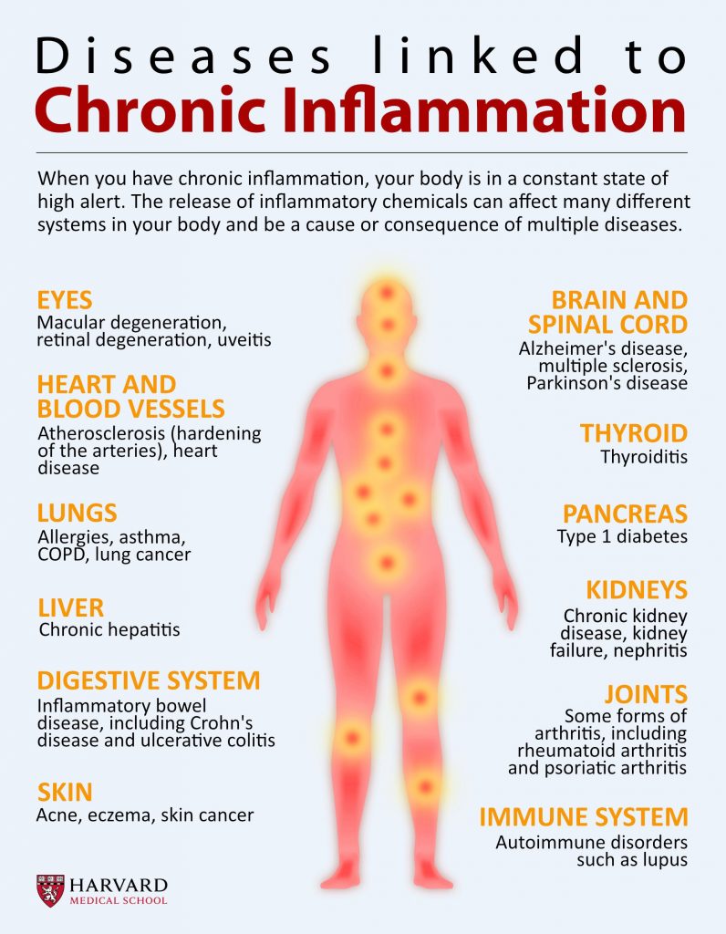 Learn all about Los Gatos inflammation and how LGSC can help.